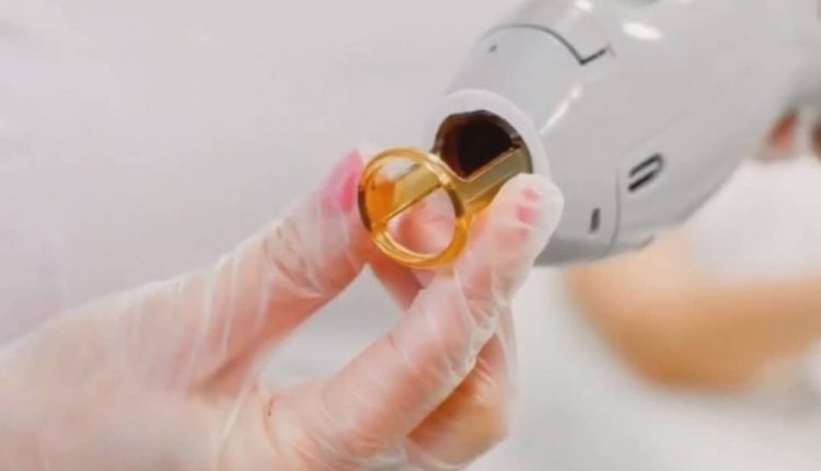 لیزر موی زائد