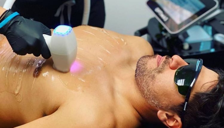 Laser hair removal