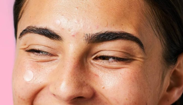 ترکاندن جوش