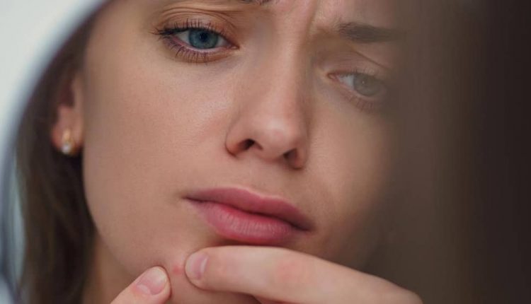 چرا جوش سرسیاه می زنم؟