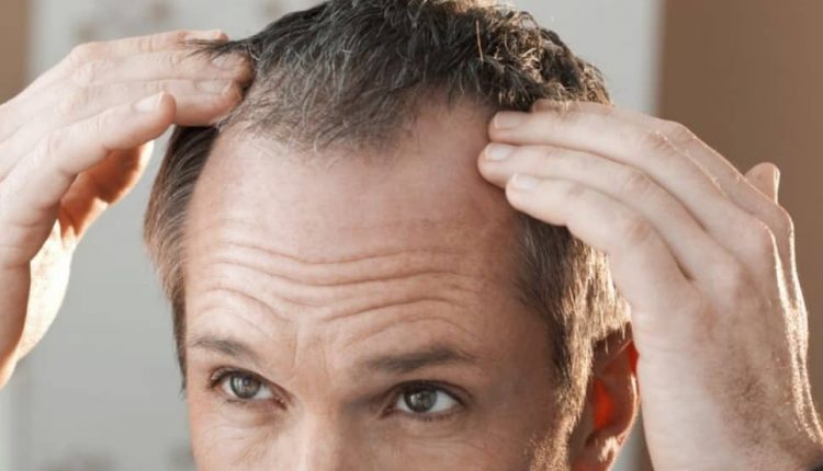 تشخیص بیماری از روی مو