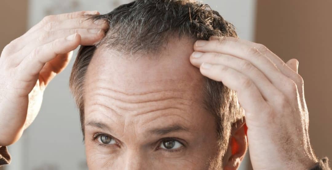 تشخیص بیماری از روی مو