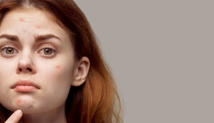 تشخیص بیماری از روی صورت