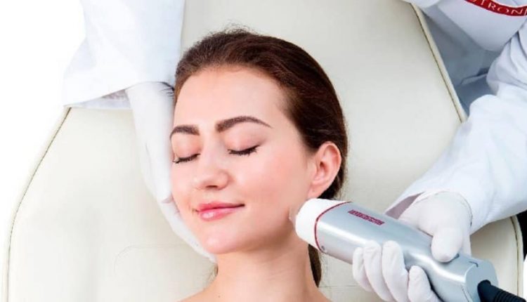 لیزر RF فرکشنال