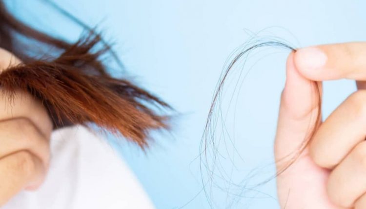 علل ریزش موی سر چیست؟