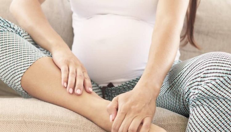 متورم شدن پاها در دوران بارداری