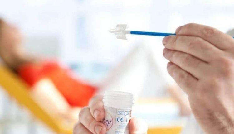 تست پاپ اسمیر