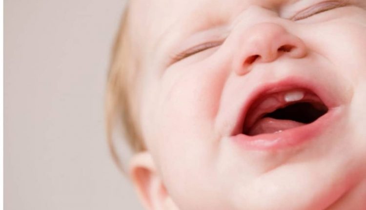 علت لکه ها روی دندان کودکان
