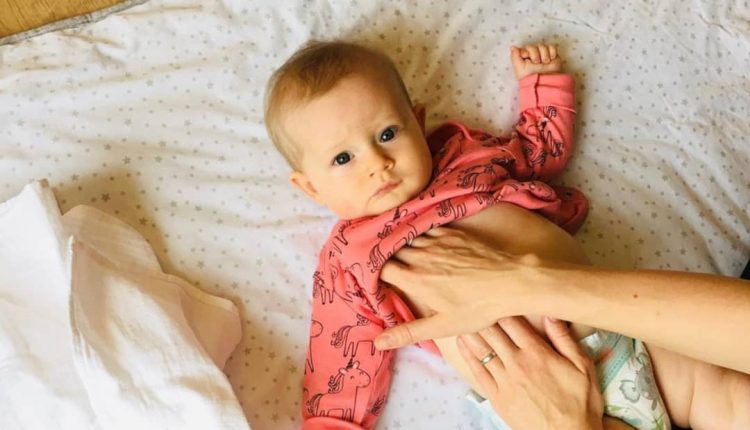  نفخ شکم نوزاد