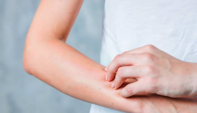 Itchy skin during pregnancy