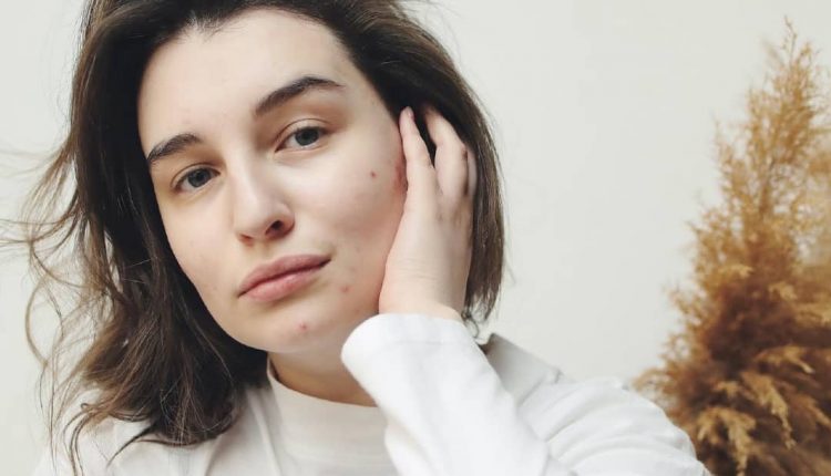 علائم نامتعادل بودن هورمون های بدن