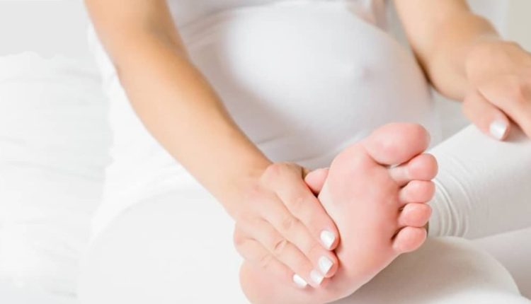 داغی دست و پا در بارداری