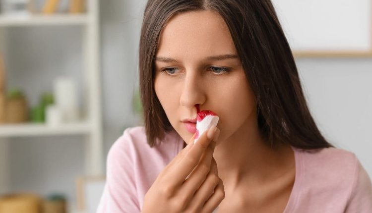 خونریزی از بینی در بارداری