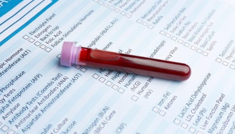 تفسیر آزمایش خون